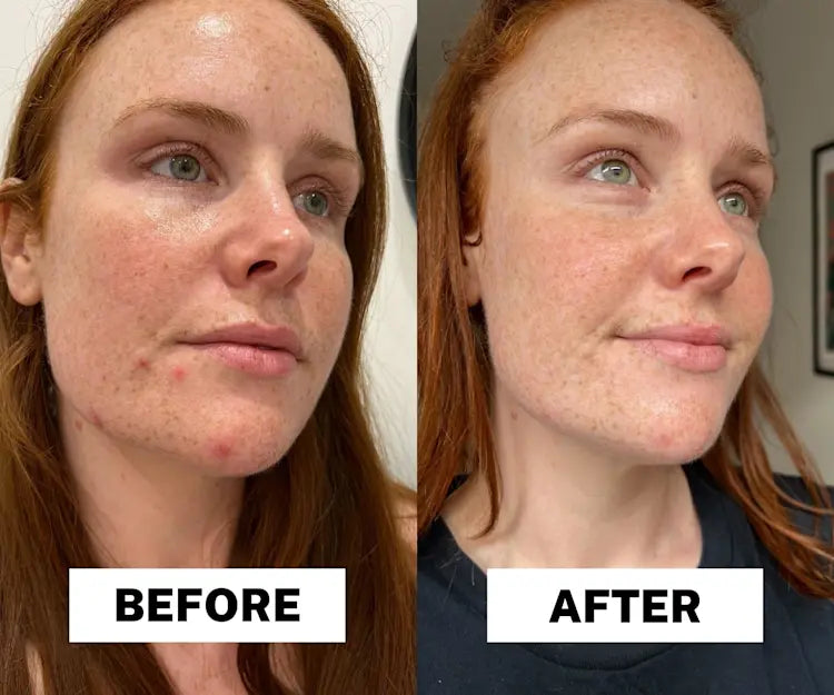 Radiant Glow Peeling