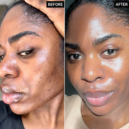 Radiant Glow Peeling
