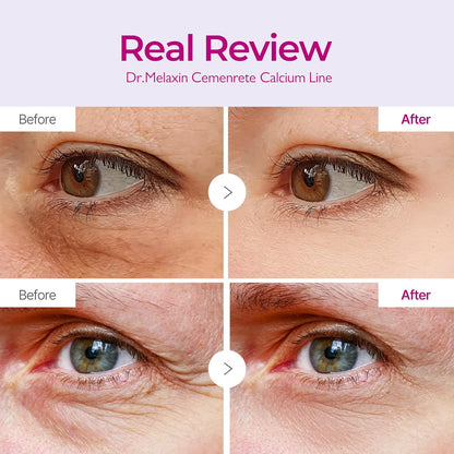 Cemenrete Calcium Volume Eye patch - Bundle