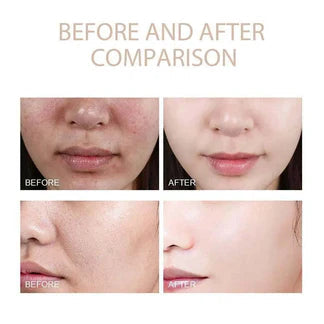 Glow Rice Glass Skin Premium Kit (6 pcs)