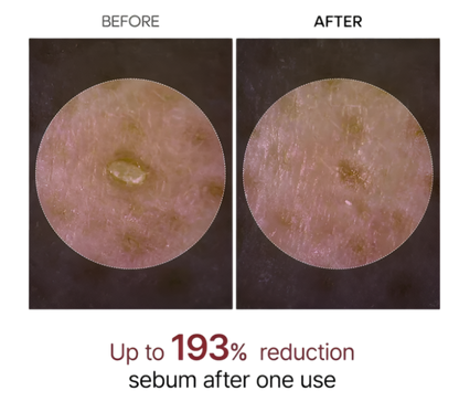 Glow Rice Glass Skin Premium Kit (6 pcs)